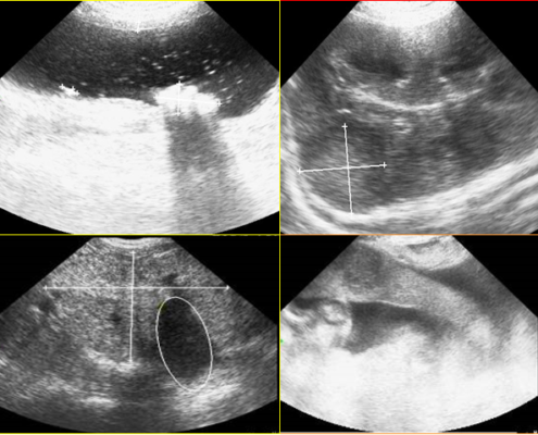 Základní sonografické vyšetření